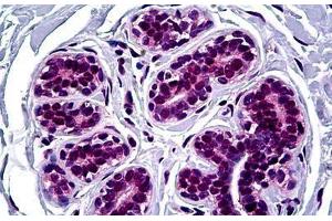 Human Breast: Formalin-Fixed, Paraffin-Embedded (FFPE) (FOXA2 antibody  (AA 363-458))