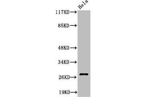 Western Blot analysis of HeLa cells using Cleaved-Integrin α6 LC (E942) Polyclonal Antibody (ITGA6 antibody  (Cleaved-Glu942))