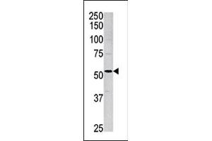 Western blot analysis of anti-ACVR1 Pab (ABIN391156 and ABIN2841266) in mouse brain tissue lysate. (ACVR1 antibody  (AA 85-123))