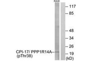 Western Blotting (WB) image for anti-Protein Phosphatase 1, Regulatory (Inhibitor) Subunit 14A (PPP1R14A) (pThr38) antibody (ABIN2888390)