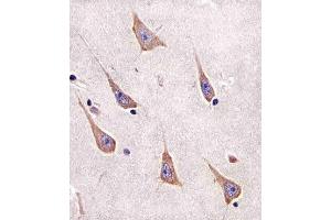 Paraformaldehyde-fixed, paraffin embedded human brain tissue, Antigen retrieval by boiling in sodium citrate buffer (pH6. (RAB11A antibody)