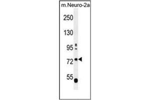 Western blot analysis of LRWD1 Antibody (N-term) in mouse Neuro-2a cell line lysates (35ug/lane). (LRWD1 antibody  (N-Term))