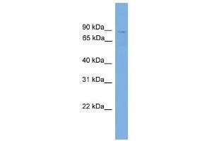 Western Blot showing QARS antibody used at a concentration of 1. (QARS antibody  (N-Term))