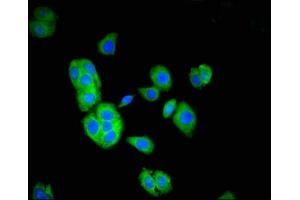 Immunofluorescent analysis of HepG2 cells using ABIN7171513 at dilution of 1:100 and Alexa Fluor 488-congugated AffiniPure Goat Anti-Rabbit IgG(H+L) (TOM1 antibody  (AA 306-487))