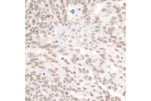 anti-Polybromo 1 (PBRM1) (AA 1639-1689) antibody