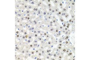 Immunohistochemistry of paraffin-embedded rat liver using U2SURP antibody (ABIN6132839, ABIN6149759, ABIN6149760 and ABIN6220240) at dilution of 1:100 (40x lens). (SR140 antibody  (AA 705-1029))