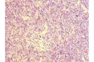 Immunohistochemistry of paraffin-embedded human thymus tissue using ABIN7161343 at dilution of 1:100 (CHRNA1 antibody  (AA 25-240))