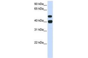 Image no. 1 for anti-Ubiquitin Specific Peptidase 22 (USP22) (AA 72-121) antibody (ABIN6741442) (USP22 antibody  (AA 72-121))
