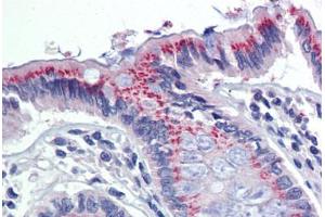 Colon, Human: Formalin-Fixed, Paraffin-Embedded (FFPE) (PDIA3 antibody)
