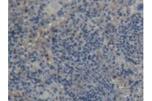 DAB staining on IHC-P; Samples: Rat Spleen Tissue (PTPRA antibody  (AA 618-796))