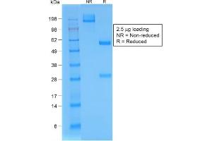 SDS-PAGE Analysis Purified BrdU Rabbit Recombinant Monoclonal Antibody (BRD/1539R). (Recombinant BrdU antibody)