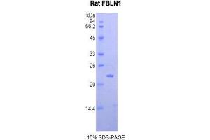 SDS-PAGE (SDS) image for Fibulin 1 (FBLN1) (AA 347-521) protein (His tag) (ABIN2121061) (Fibulin 1 Protein (FBLN1) (AA 347-521) (His tag))