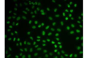 Immunofluorescence (IF) image for anti-Cardiac Troponin C (TNNC1) (AA 1-160) antibody (ABIN3015719) (TNNC1 antibody  (AA 1-160))