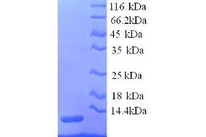 Apolipoprotein C-III (APOC3) (AA 21-101), (full length) protein (His tag) (APOC3 Protein (AA 21-101, full length) (His tag))