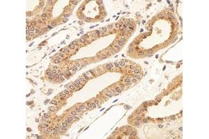 Immunohistochemistry analysis of paraffin-embedded human kidney using,RISC (ABIN7075546) at dilution of 1: 4000 (SCPEP1 antibody)