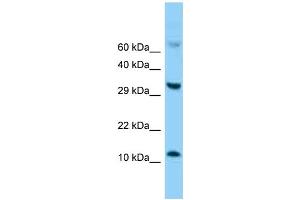 Western Blotting (WB) image for anti-Fatty Acid Binding Protein 5 (Psoriasis-Associated) (FABP5) (C-Term) antibody (ABIN2788321) (FABP5 antibody  (C-Term))