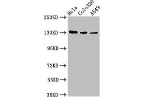 Western Blot Positive WB detected in: Hela whole cell lysate, Colo320 whole cell lysate, A549 whole cell lysate All lanes: ITGAV antibody at 2. (CD51 antibody  (AA 775-885))