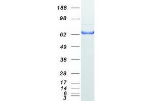 Validation with Western Blot