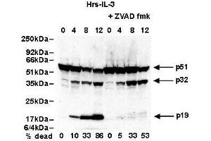 Western Blotting (WB) image for anti-Caspase 2, Apoptosis-Related Cysteine Peptidase (CASP2) antibody (ABIN187544) (Caspase 2 antibody)