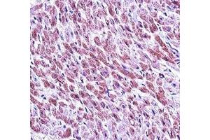 Immunohistochemistry (IHC) image for anti-SMAD, Mothers Against DPP Homolog 3 (SMAD3) (AA 127-156) antibody (ABIN3032620)