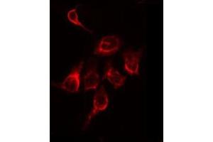 Immunofluorescence (fixed cells) (IF/ICC) image for anti-Matrix Metallopeptidase 11 (Stromelysin 3) (MMP11) (N-Term) antibody (ABIN6263291)
