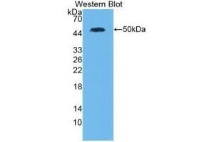 Detection of Recombinant IL28A, Human using Monoclonal Antibody to Interleukin 28A (IL28A)