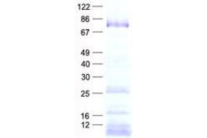 Western Blotting (WB) image for DEAD (Asp-Glu-Ala-Asp) Box Polypeptide 18 (DDX18) protein (His tag) (ABIN2719275)