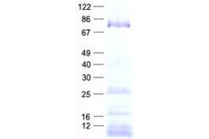 Validation with Western Blot (DDX18 Protein (His tag))