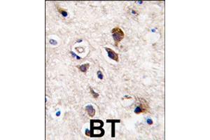 Formalin-fixed and paraffin-embedded human brain tissue reacted with PRKCG polyclonal antibody  , which was peroxidase-conjugated to the secondary antibody, followed by DAB staining . (PKC gamma antibody  (C-Term))