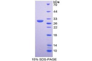 SDS-PAGE (SDS) image for GATA Binding Protein 1 (Globin Transcription Factor 1) (GATA1) (AA 150-384) protein (His tag) (ABIN2124928) (GATA1 Protein (AA 150-384) (His tag))