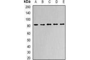 Western blot analysis of APEH expression in Jurkat (A), HepG2 (B), mouse liver (C), mouse kidney (D), rat bone marrow (E) whole cell lysates. (APEH antibody)