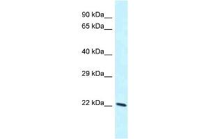 WB Suggested Anti-Laptm4b Antibody Titration: 1. (LAPTM4B antibody  (C-Term))