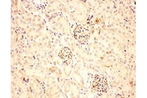 IHC-P: ACTH antibody testing of mouse kidney tissue (ACTH antibody  (Middle Region))