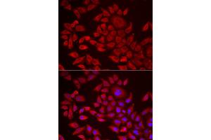 Immunofluorescence analysis of HeLa cells using AGPAT2 antibody.