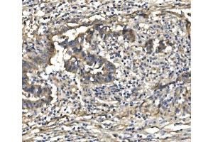 IHC analysis of PDE6 beta/PDE6B using anti-PDE6 beta/PDE6B antibody (ABIN7600894). (PDE6B antibody  (AA 25-237))