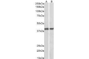 ABIN625823 (0. (GNAQ antibody  (AA 162-175))
