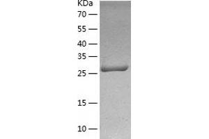 Western Blotting (WB) image for Zinc Finger Protein 33A (ZNF33A) (AA 453-738) protein (His tag) (ABIN7286982) (ZNF33A Protein (AA 453-738) (His tag))
