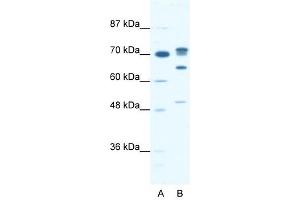 DDX21 antibody used at 0. (DDX21 antibody)