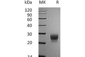 G-CSF Protein (His tag)