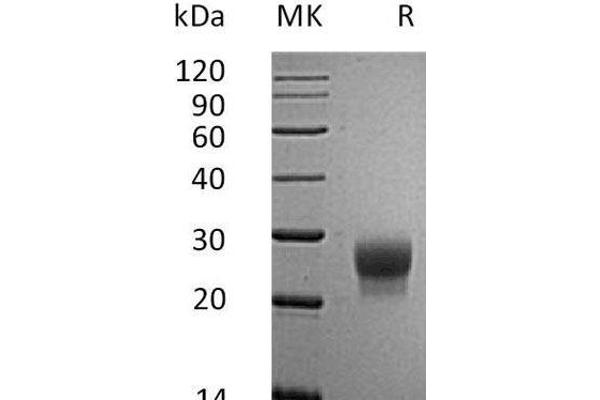 G-CSF Protein (His tag)