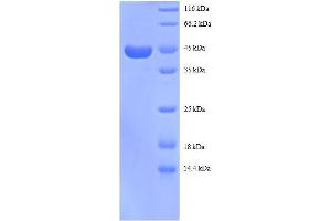 Ribosomal Protein S13 (RPS13) (AA 3-151), (partial) protein (GST tag) (RPS13 Protein (AA 3-151, partial) (GST tag))