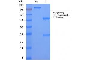 SDS-PAGE Analysis Serum Amyloid A Rabbit Recombinant Monoclonal Antibody (SAA/2868R). (Recombinant SAA antibody)