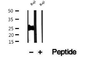 Western blot analysis of extracts of Raji cells, using PCMT1 antibody.