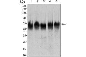 Western Blotting (WB) image for anti-Tubulin, beta 2A (TUBB2A) (AA 25-187) antibody (ABIN1846607) (TUBB2A antibody  (AA 25-187))