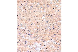 Immunohistochemistry of paraffin-embedded Mouse heart using ME3 Rabbit pAb (ABIN7268384) at dilution of 1:100 (40x lens). (ME3 antibody  (AA 505-604))