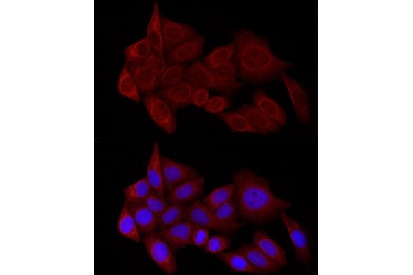 Syntaxin 17 antibody  (AA 1-130)