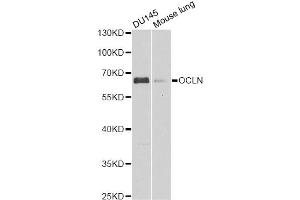 Western blot analysis of extracts of various cell lines, using OCLN antibody. (Occludin antibody)