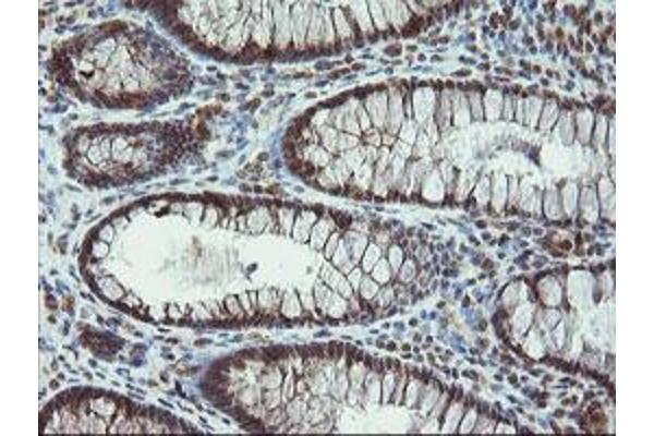 PROSC antibody