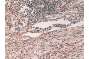 Immunohistochemistry (IHC) image for anti-ATPase, Cu++ Transporting, beta Polypeptide (ATP7B) (AA 59-426) antibody (ABIN7441340)