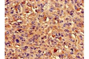 ARAP3 antibody  (AA 163-320)